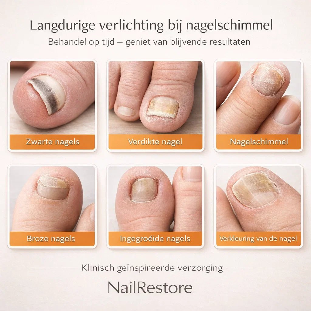 NailRestore – Herstel je nagels zichtbaar van binnenuit